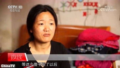 重庆专业的银屑病医院有哪些_xc sports(图2) xc体育