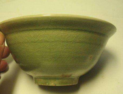 偏头痛的症状表现是什么如何及时改善|xc sports(图2) xc sports